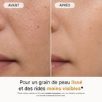 GT Lumina® - Masque LED 5 longueurs d'onde