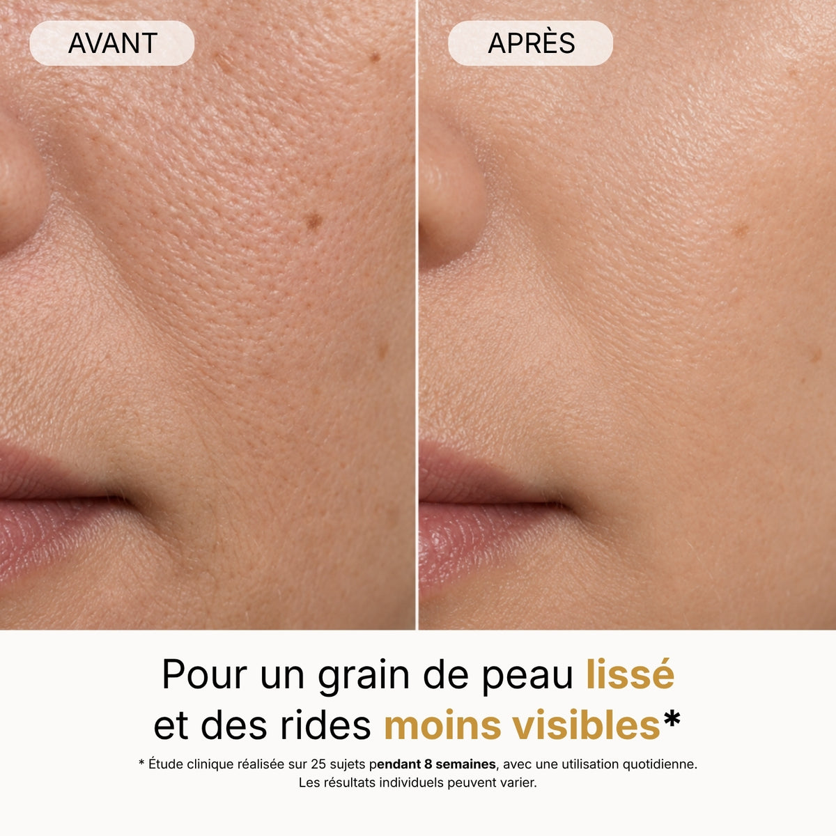 GT Lumina® - Masque LED 5 longueurs d'onde